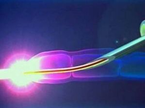 Laser na poslu